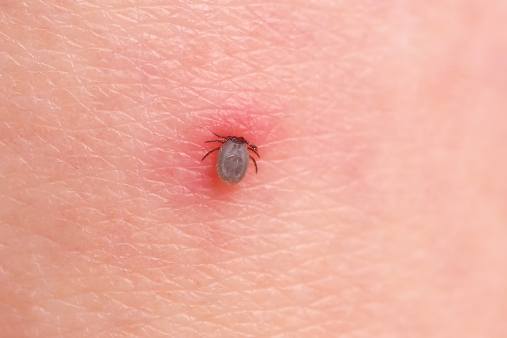 Doença de Lyme transmitida por carrapatos