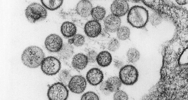 Orthohantavirus