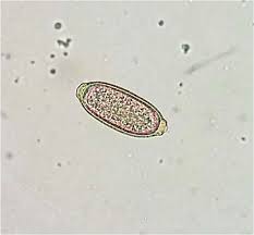 Capillaria philippinensis