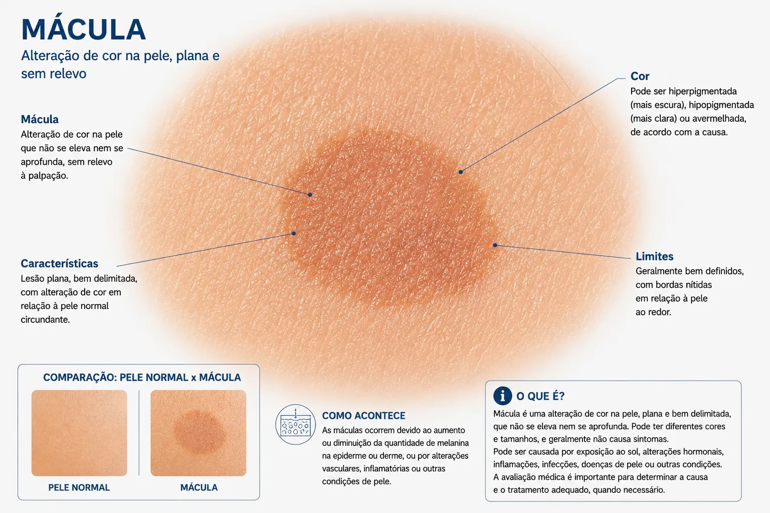 Estrutura em destaque da mácula
