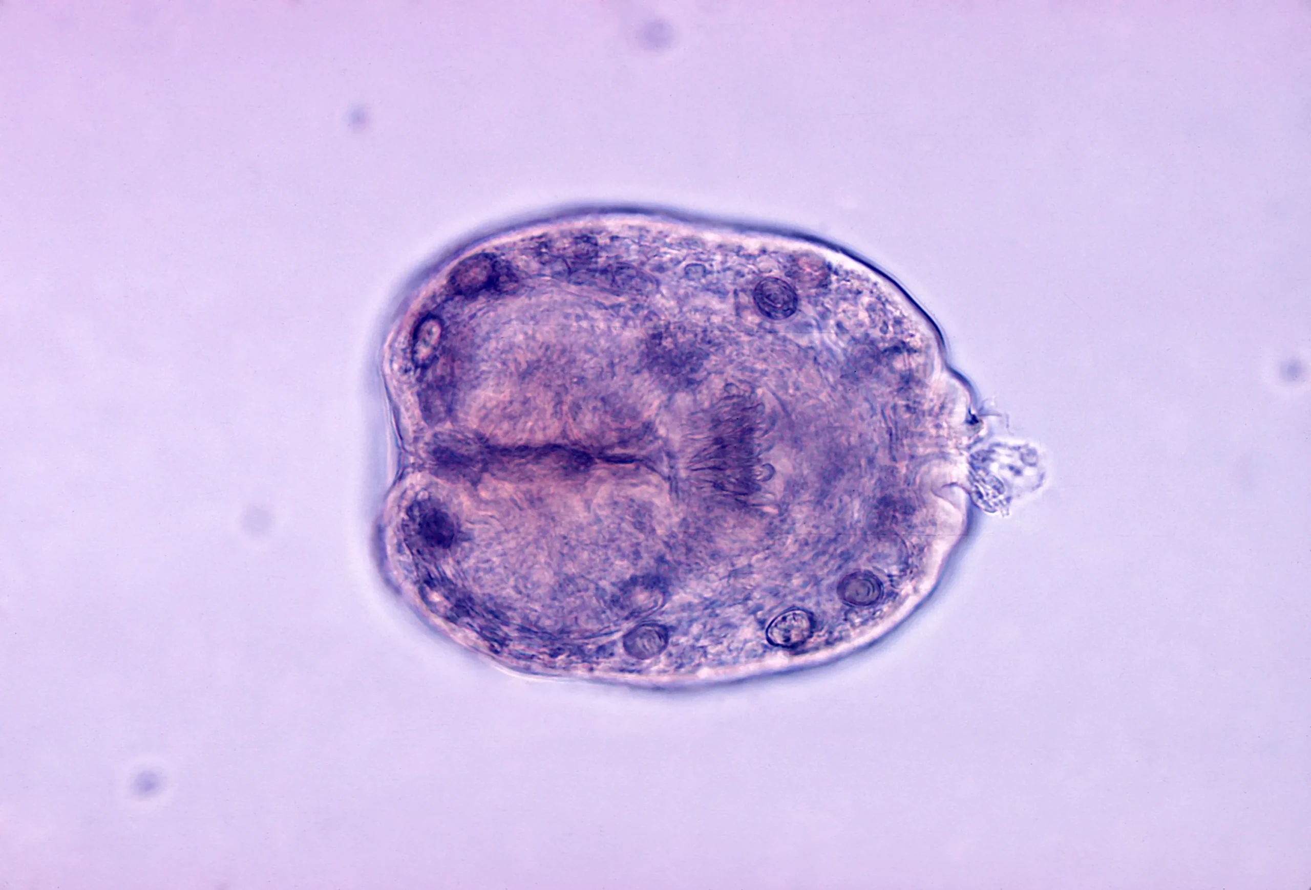 Echinococcus granulosus sensu lato
