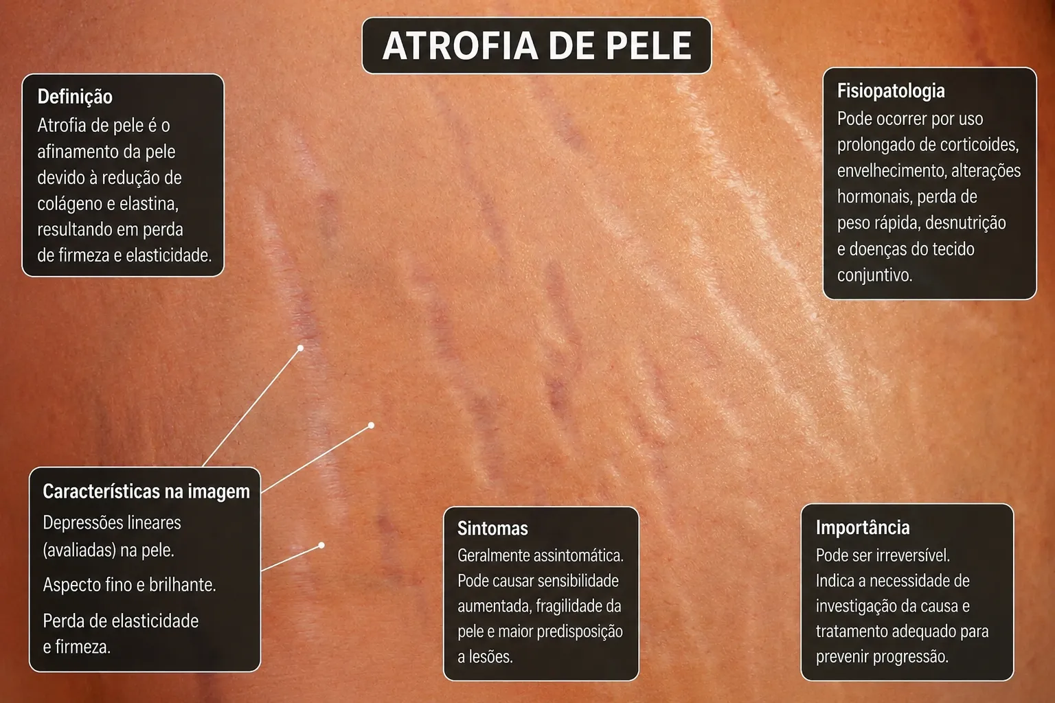 Atrofia de pele