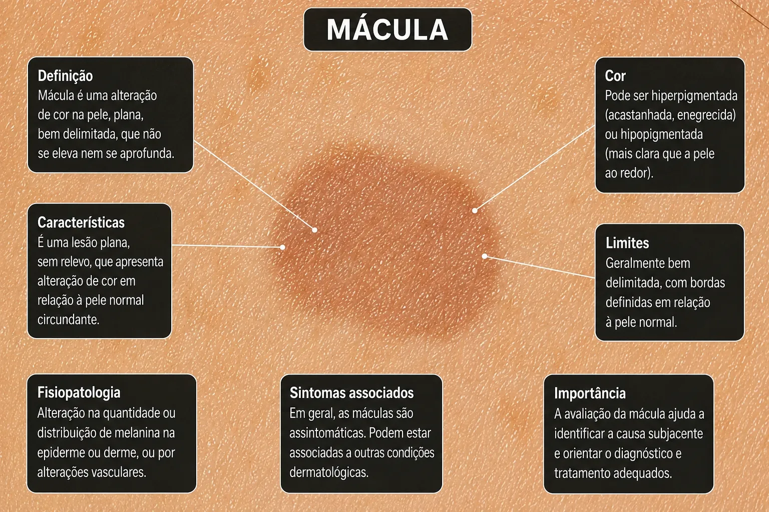 Mácula