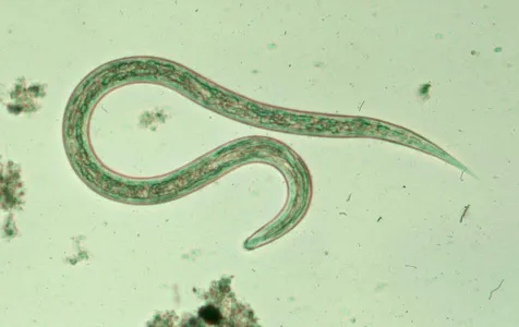 N. americanus e A. duodenale
