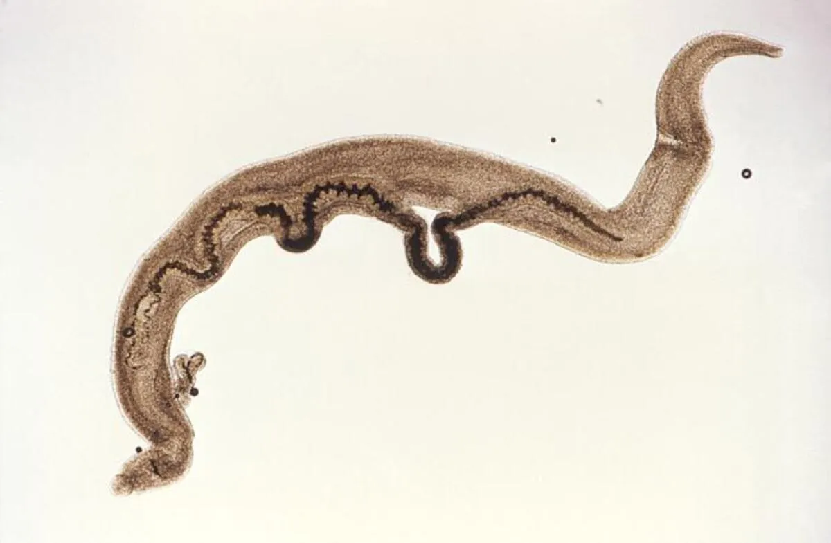 Schistosoma mansoni