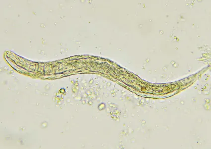 Strongyloides stercoralis