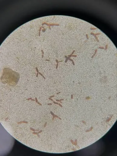 Geotrichum candidum