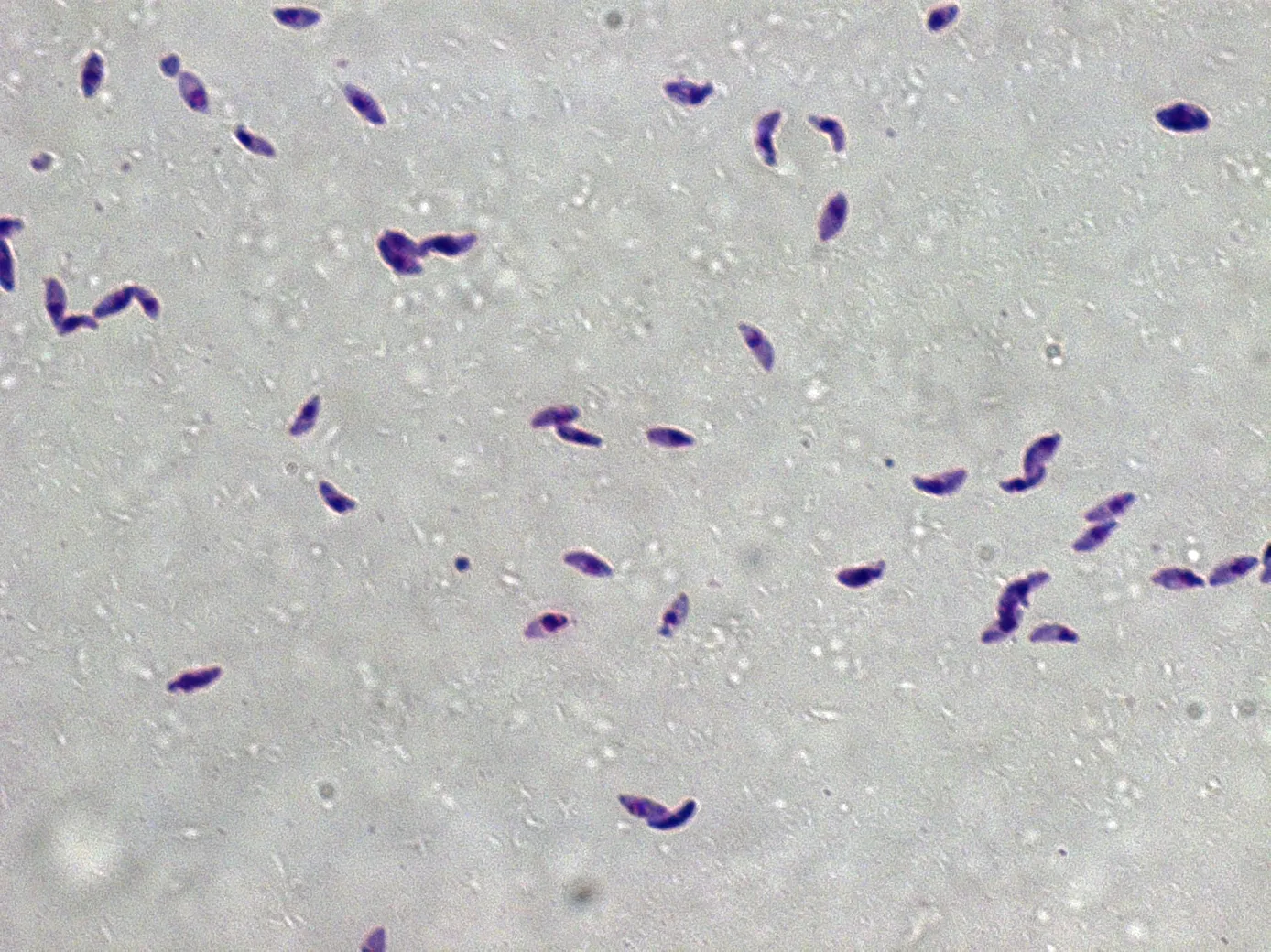 Toxoplasma gondii