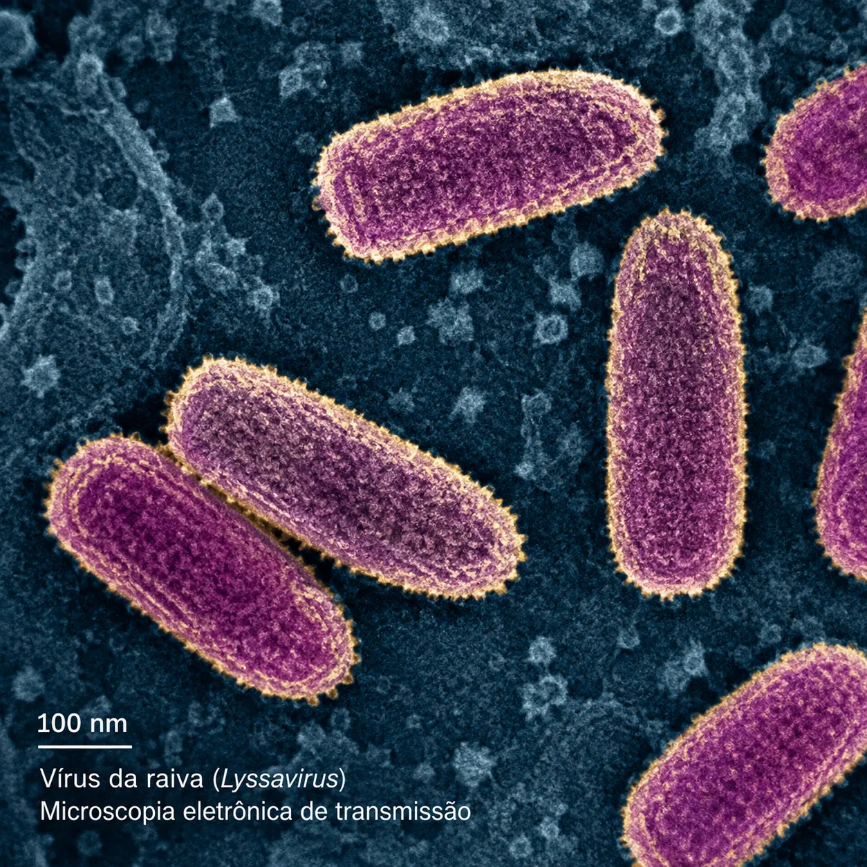 Rabies lyssavirus